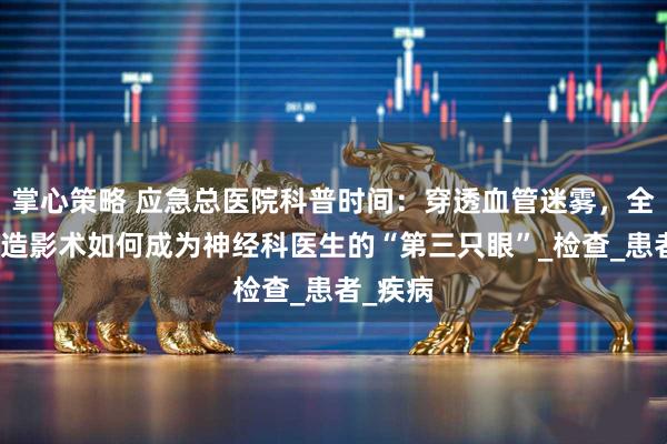 掌心策略 应急总医院科普时间：穿透血管迷雾，全脑血管造影术如何成为神经科医生的“第三只眼”_检查_患者_疾病